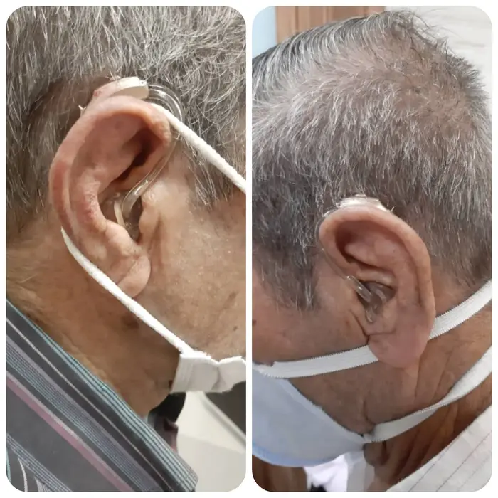 کلینیک سمعک اقدسیه - تجویز سمعک +Vitus فوناک برای مراجع 70 ساله