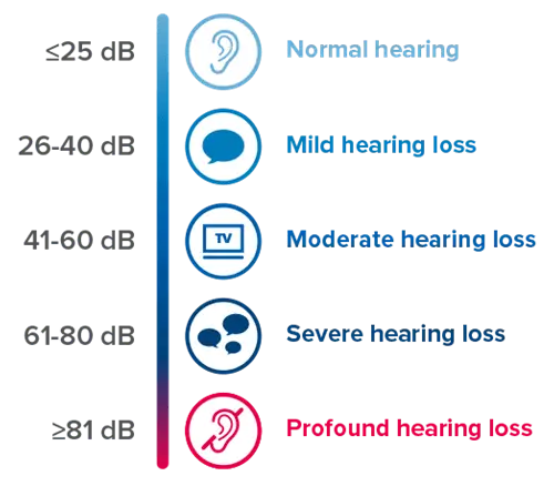 سمعک سوپر پاور
