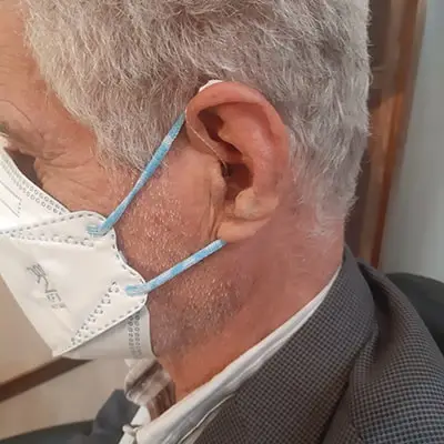 تجویز استایلتو 3x در یک فرد با کم شنوایی متوسط در هردوگوش