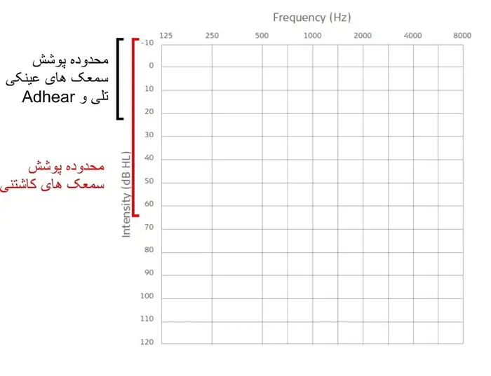 مزیت سمعک های استخوانی کاشتنی 