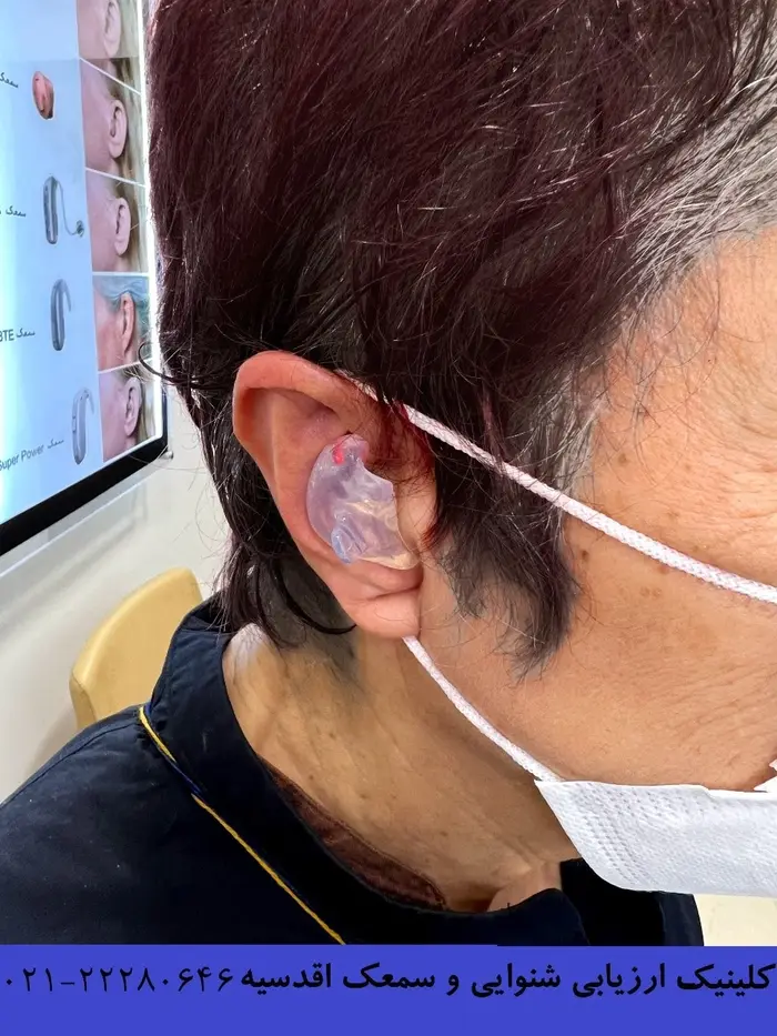  تجویز قالب ضد آب 