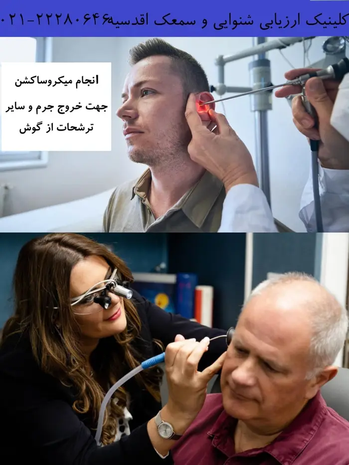 میکروساکشن