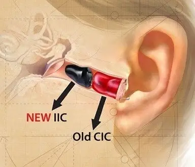 فرق سمعک icc و cic