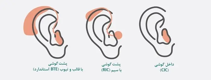 انواع سمعک گوش