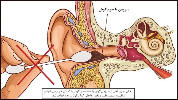 درد گوش و گوش پاک کن