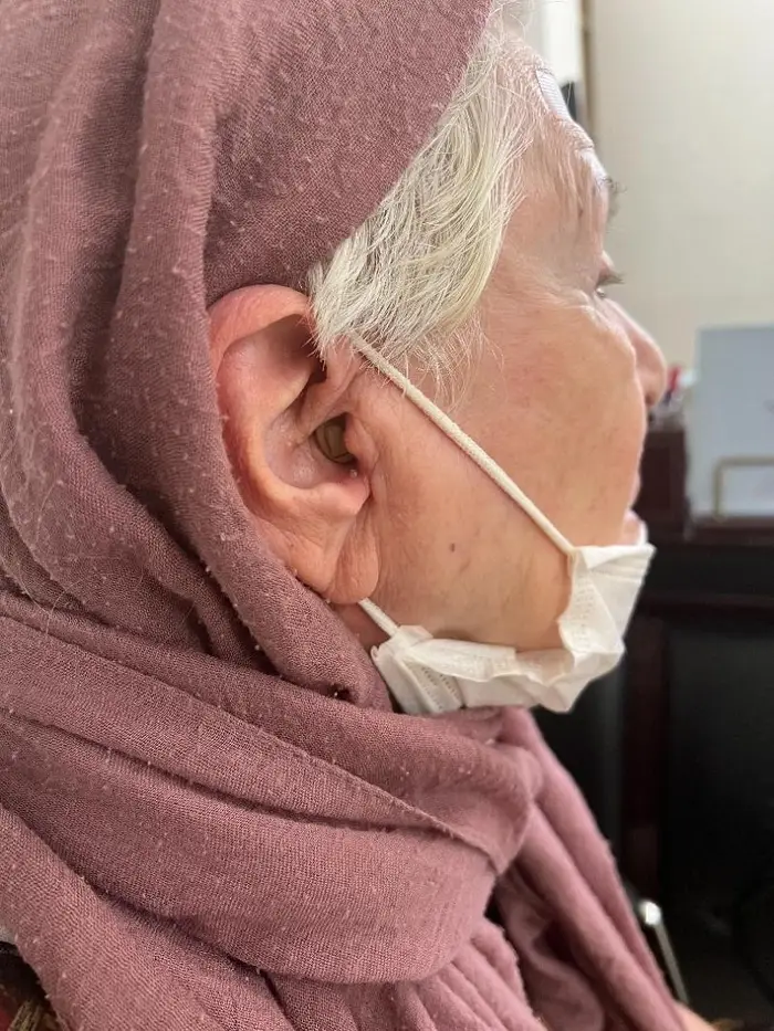 نمونه تجویز سمعک نامرئی cic در کلینیک سمعک اقدسیه