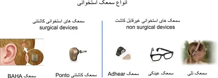انواع سمعک های استخوانی