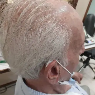  تجویز سمعک Prescription 7x