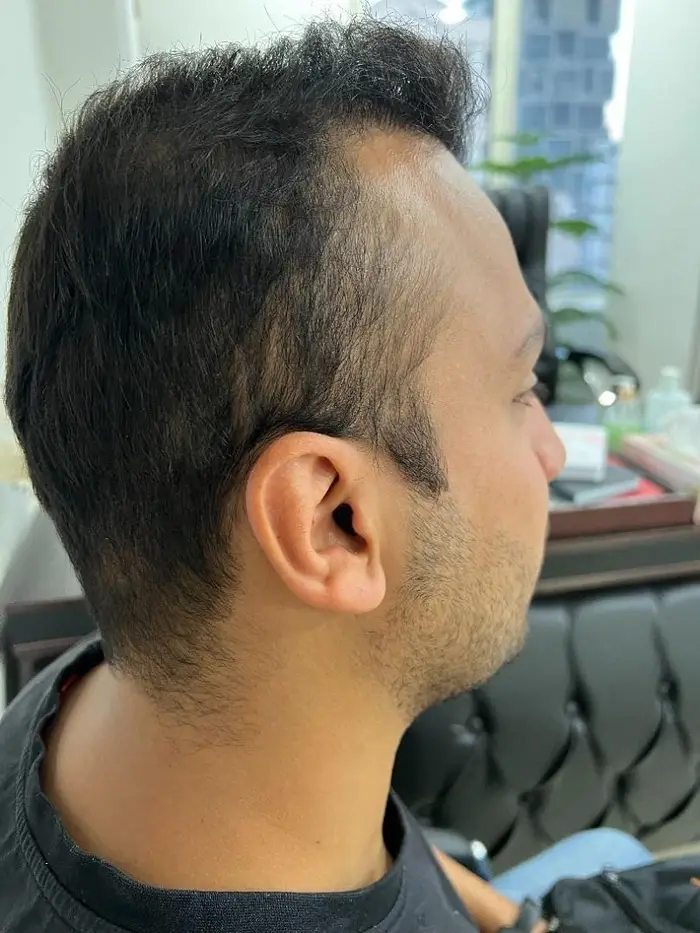 نمونه تجویز سمعک نامرئی cic در کلینیک سمعک اقدسیه