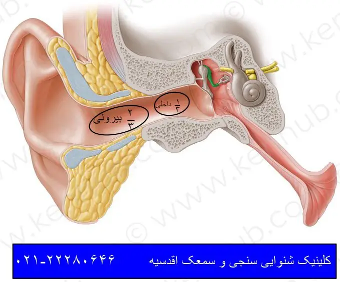 سمعک نامرئی برای چه افرادی مناسب است ؟