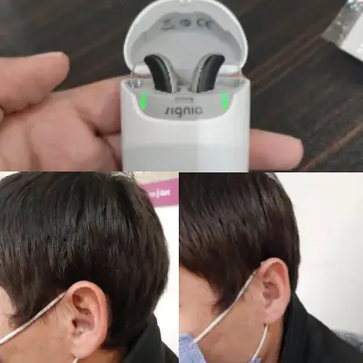 تجویز استایلتو 7x رنگ مشکی نقره ای در یک فرد ۴۰