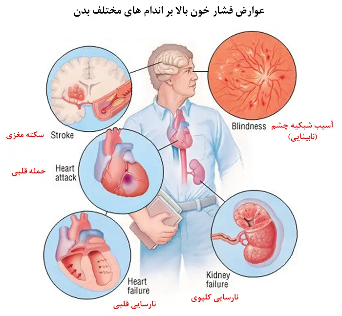 عوارض فشار خون بالا بر اندام‌های مختلف بدن