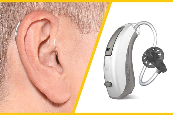 سمعک به چه افرادی توصیه میشود؟