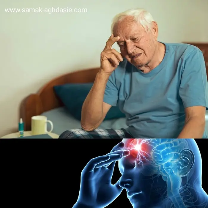 زوال عقل چیست؟