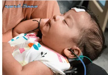 آماده سازی نوزاد برای تست ABR 