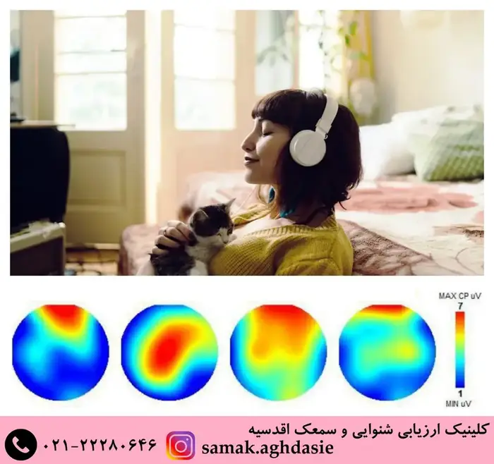 تغییرالگوی امواج مغزی