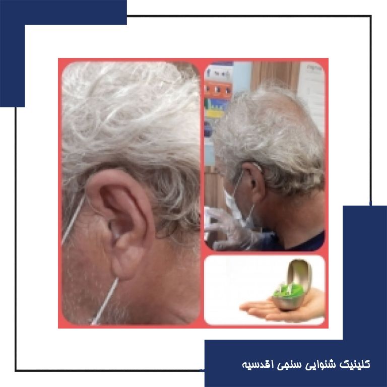 تجویز سمعک Audeo m50 فوناک (مدل RIC)  به همراه سمعک CROS برای مراجع 65 ساله مبتلا به کم شنوایی عمیق در گوش راست و کم شنوایی شدید در گوش چپ