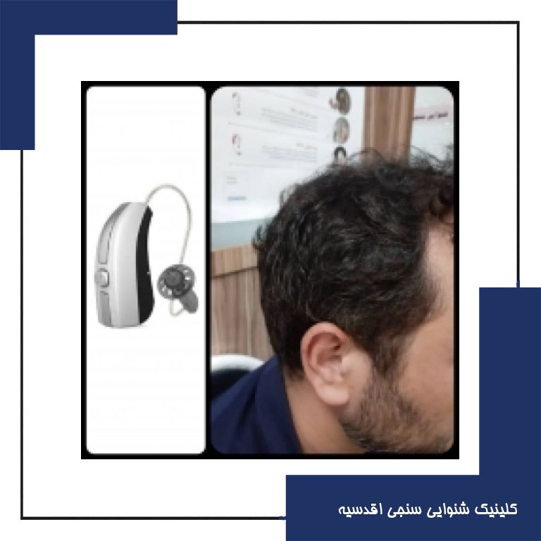 تجویز سمعک Evoke 440 ویدکس (مدل RIC) برای مراجع 35 ساله مبتلا به کم شنوایی متوسط دوطرفه در فرکانس های بالاتر از 2 KHz