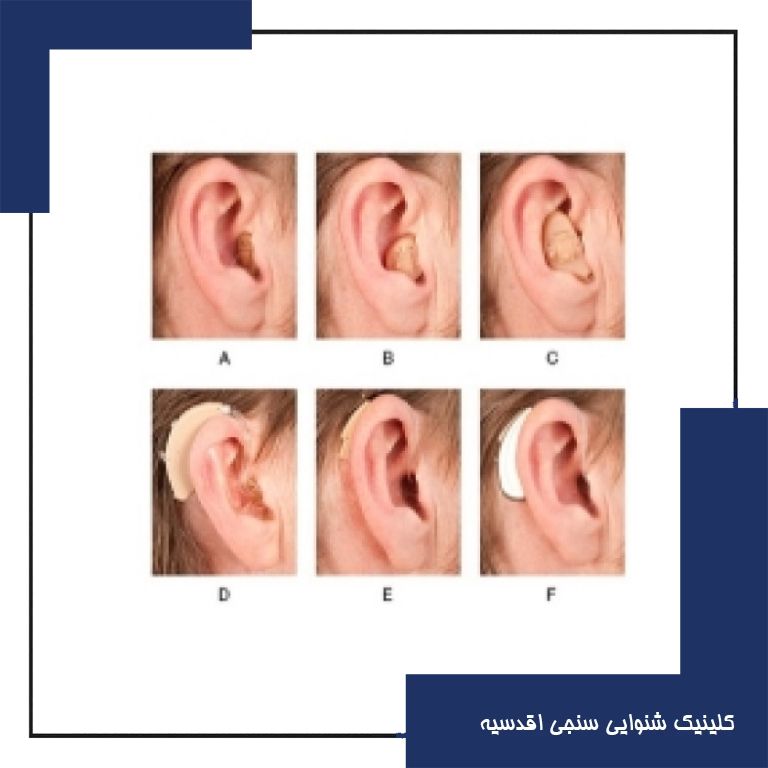 انواع سمعک ها و ویژگی آن ها