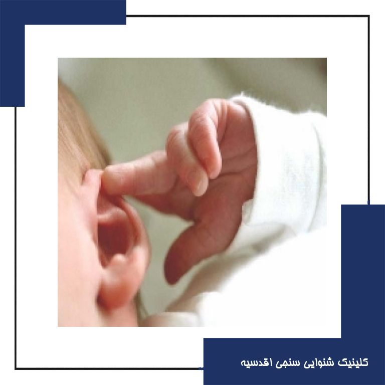 بد شکلی گوش نوزادان