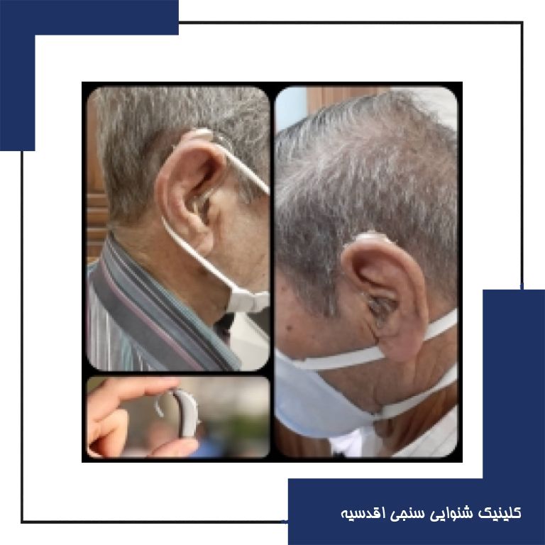 تجویز سمعک +Vitus فوناک (مدل پشت گوشی) برای مراجع 70 ساله مبتلا به کم شنوایی شدید تا عمیق دوطرفه