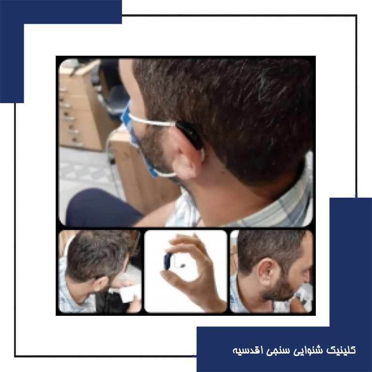 تجویز سمعک Opn اتیکن (مدل RIC) رنگ مشکی برای مراجع 35 ساله مبتلا به کم شنوایی متوسط دوطرفه