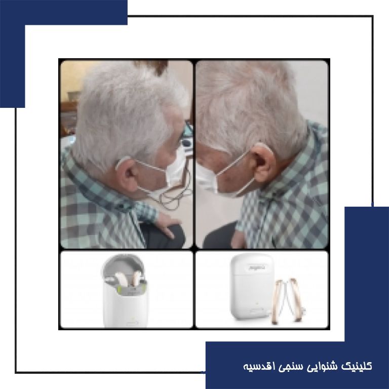 تجویز سمعک Styletto 3x زیمنس (مدل RIC) برای مراجع 73 ساله مبتلا به کم شنوایی متوسط تا شدید در هر دو گوش