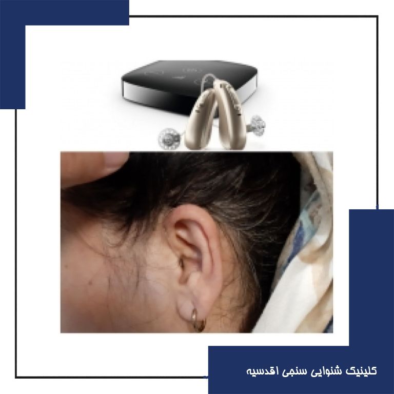 تجویز سمعک فوناک در یک فرد 35 ساله با کم شنوایی متوسط