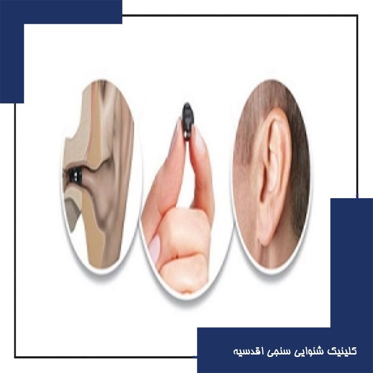 سمعک نامرئی|سمعک iic