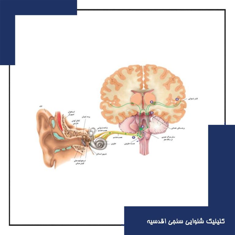 تست ABR چیست؟