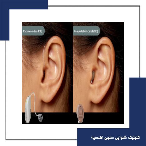 سمعک داخل گوشی بهتر است یا پشت گوشی؟