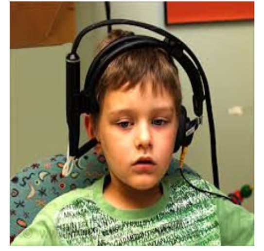 ارزیابی رفلکس اکوستیک