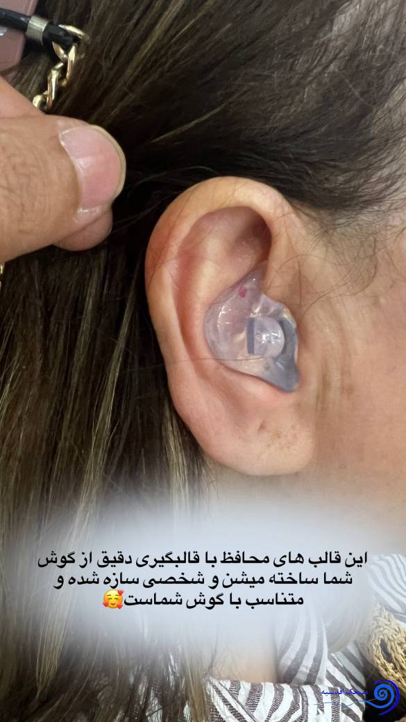 قالب گیری دقیق از گوش