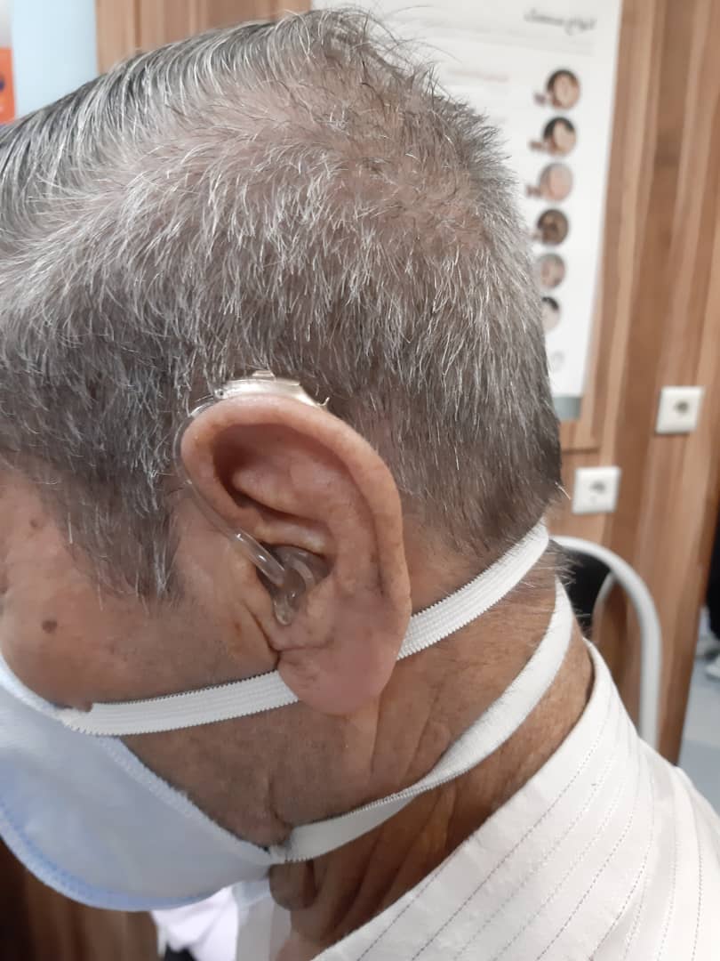 تجویز سمعک ویتوس پلاس فوناک برای بیمار هفتاد ساله با کم شنوایی شدید تا عمیق در هر دو گوش