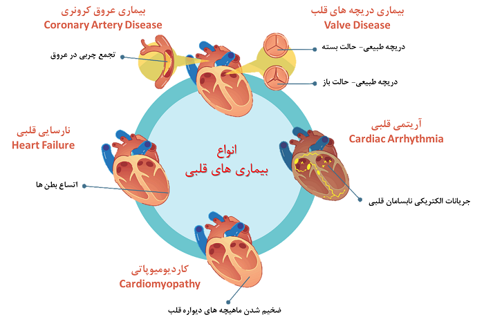 عفونت های قلبی