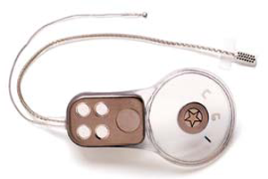 cochlear company brain stem implantation