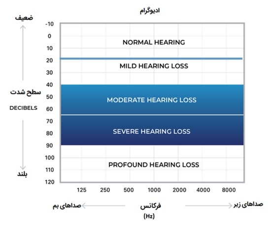 Average hearing thresholds