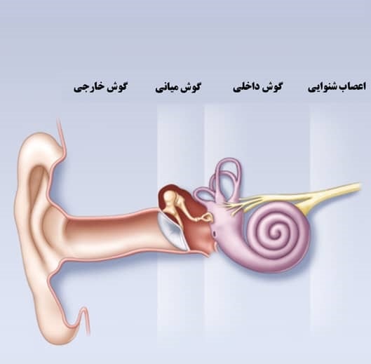 درمان ناشنوایی ناگهانی