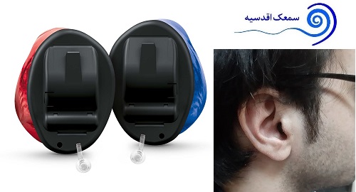 سمعک IIC سیگنیا- نمونه ی تجویز برای بیمار در کلینیک سمعک اقدسیه