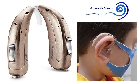 سمعک Motion سیگنیا- نمونه ی تجویز در کلینیک سمعک اقدسیه