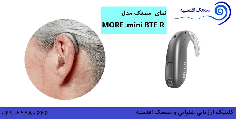 نحوه قرارگیری سمعک‌ MINI BTE R بر روی گوش کاربر 